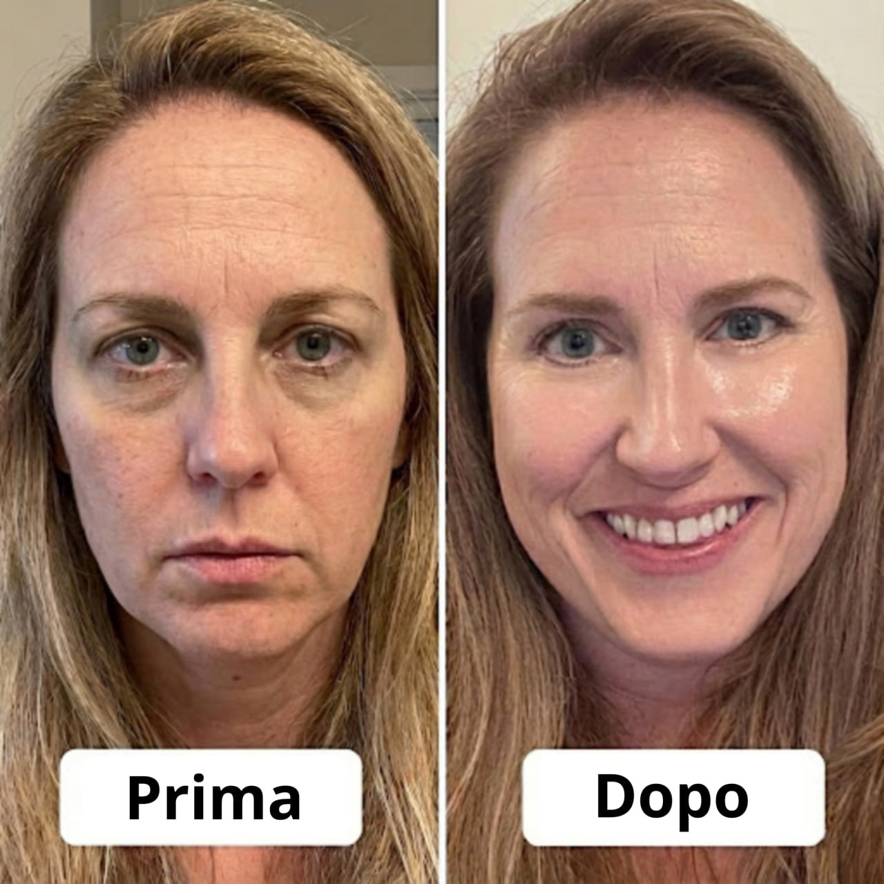 Veliana Glowpads Pro