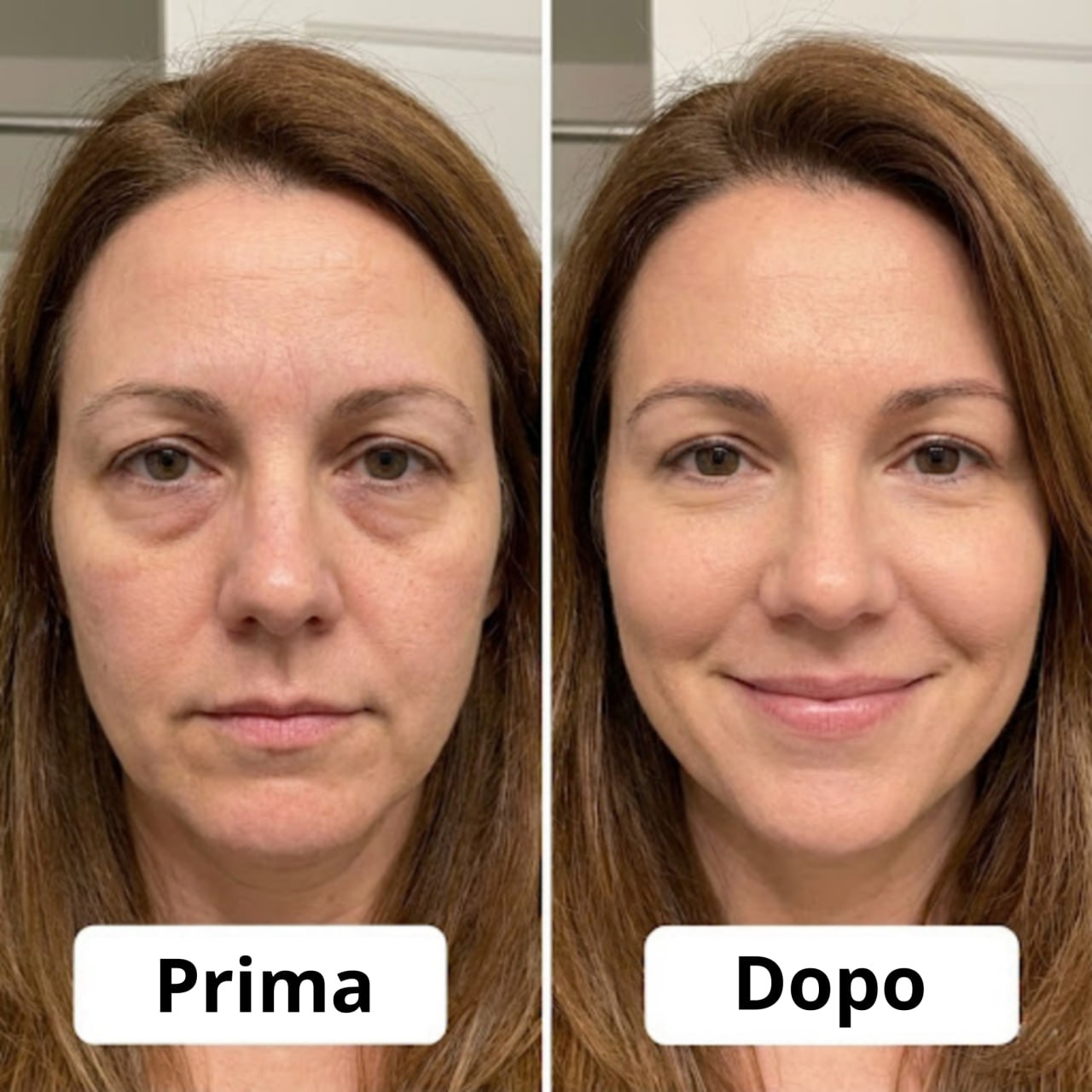 Veliana Glowpads Pro